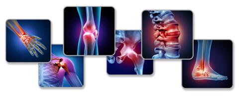 Pain of the joints